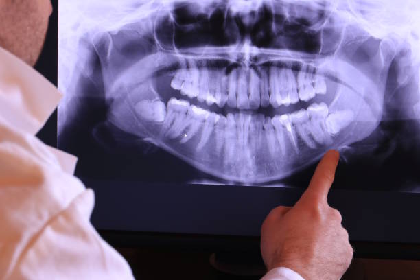Emergency Dental Filling Replacement in MA