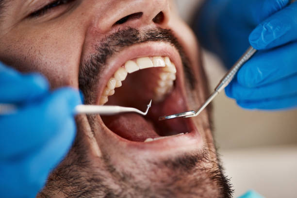 Best Dentist for Tooth Abscess  in Quincy, MA